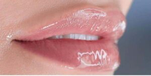Hydra gloss lips